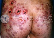 Ԥ����������񰸴����7������