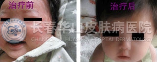 �沿������Ƥ����������