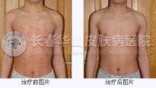 ���ư����Ա�
